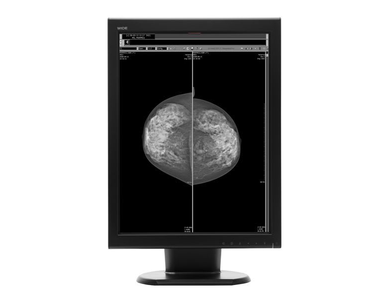 LCD display / monochrome / medical 21.3", 5 MP | MX50s WIDE Europe