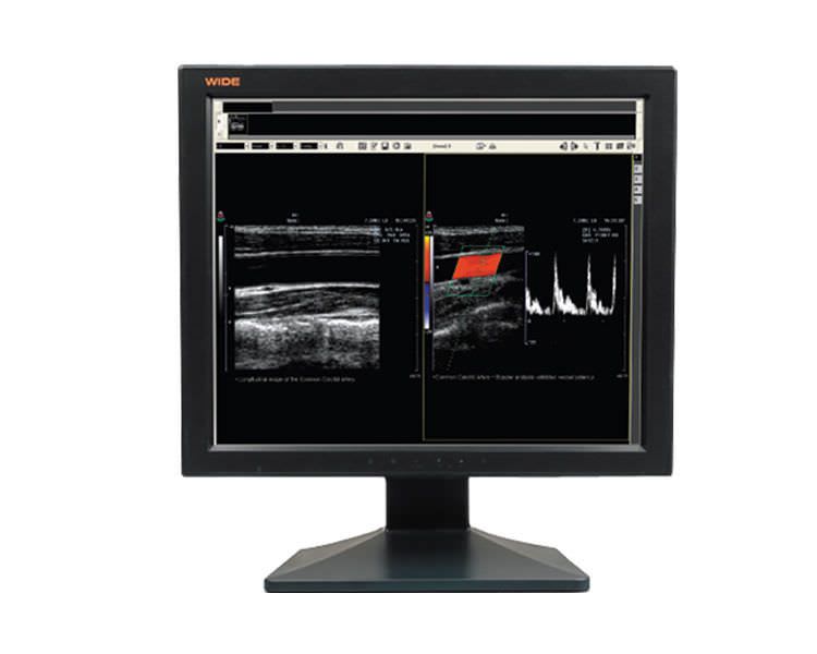 LCD display / medical 19", 1 MP | IF1911C WIDE Europe