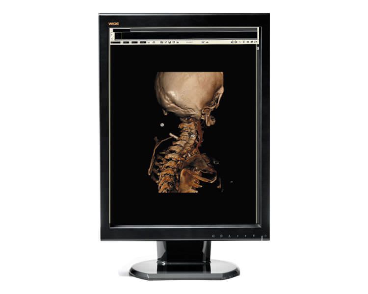 LCD display / medical 21.3", 2 MP | CX20 WIDE Europe