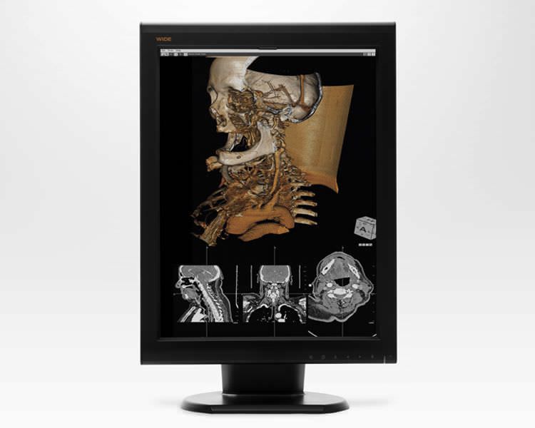 LCD display / medical 28.49", 6 MP | CX60 WIDE Europe
