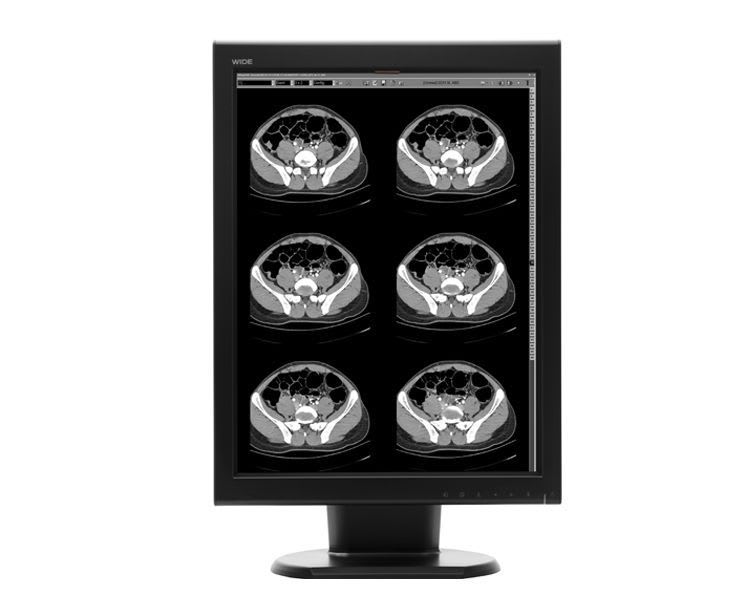 LCD display / monochrome / medical 20.3", 2 MP | MX20s WIDE Europe
