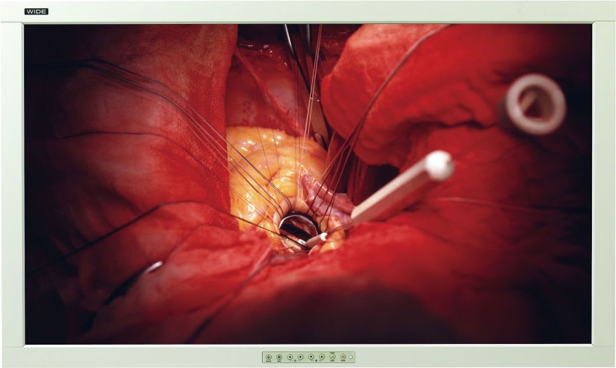 High-definition display / surgical 42", 2 MP | SD4200CW WIDE Europe