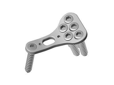 Radial head compression bone plate TST R. Medical Devices