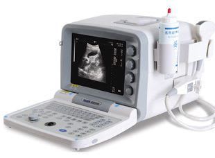 Portable ultrasound system / for gynecological and obstetric ultrasound imaging KX2000G (09) Xuzhou Kaixin Electronic Instrument