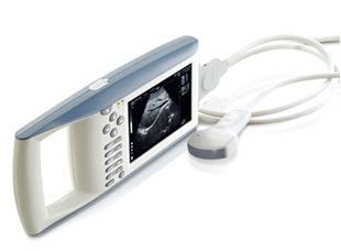 Hand-held ultrasound system / for gynecological and obstetric ultrasound imaging KX5100 Xuzhou Kaixin Electronic Instrument