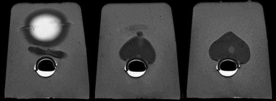 CT scan test phantom / for ultrasound imaging / prostate Yezitronix