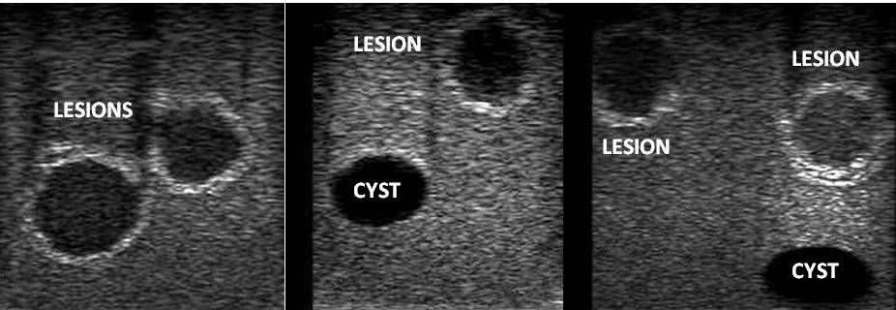 Ultrasound imaging test phantom / breast Yezitronix