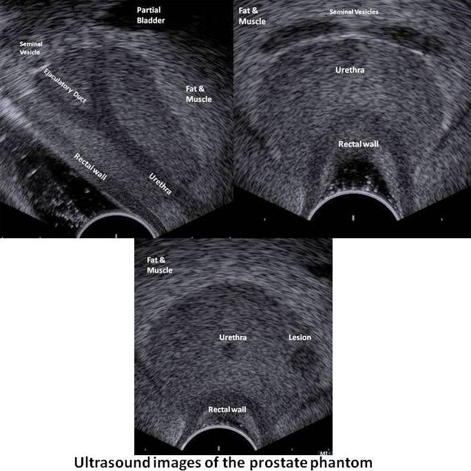Ultrasound imaging test phantom / prostate END-FIRE MODE Yezitronix