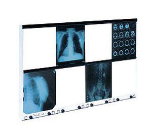 White light X-ray film viewer / 8-section / variable-speed / with switch 4200 cd/m², 144 x 96 cm | NGP-81 Ultraviol