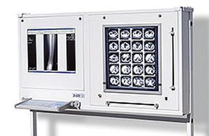 Digital X-ray film viewer / 1-section DICO 1M/1B Ultraviol