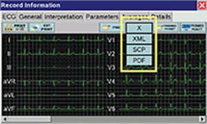 Digital electrocardiograph / 12-channel CARDIPIA 400 smart TRISMED