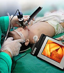 Laryngoscope video endoscope / rigid Truview PCD Pediatric Truphatek International