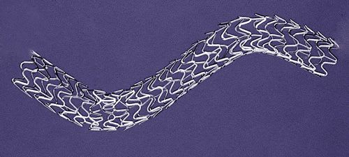 Coronary stent / stainless steel / with applicator ProLink LP Vascular Concepts