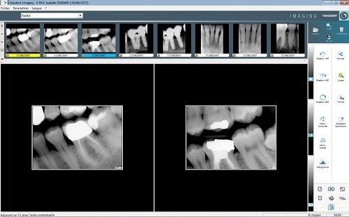Dental imaging software / medical VISIODENT Imaging VISIODENT SA