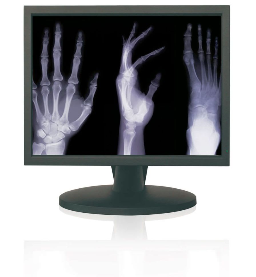 LCD display / high-definition / medical 21.3" | MED-TFT TCI
