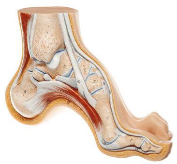 Foot pathology anatomical model NS 3 SOMSO