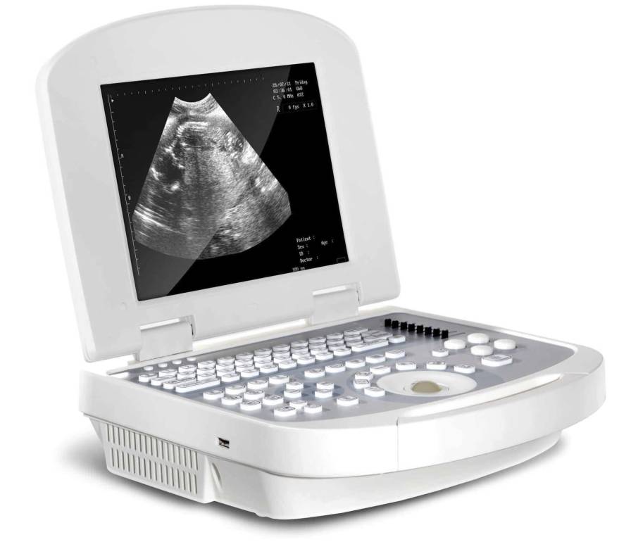 Portable ultrasound system / for multipurpose ultrasound imaging 3W-2000 Sunway Medical