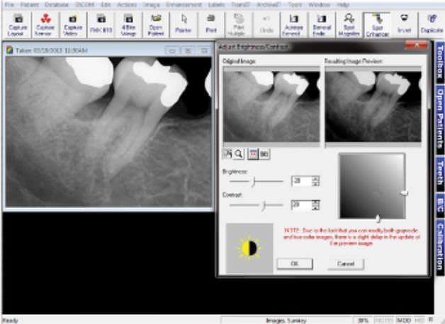 Image capture software / data management / diagnostic / for dental imaging Prof. Suni Suni Medical Imaging