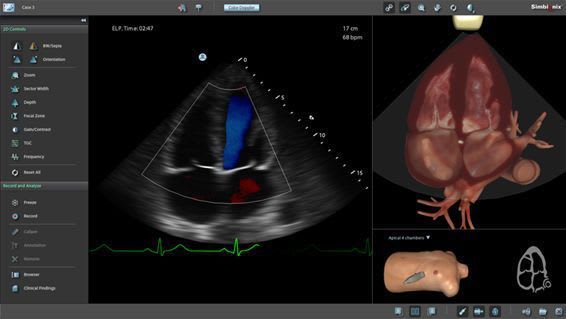 Ultrasound imaging training simulator U/S Mentor™ Simbionix
