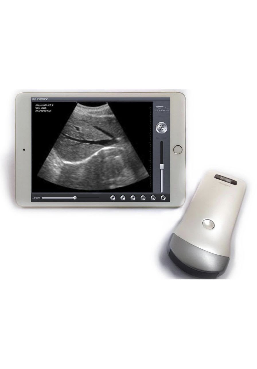 Hand-held ultrasound system / for multipurpose ultrasound imaging / wireless probe SP-8000 SonopTek