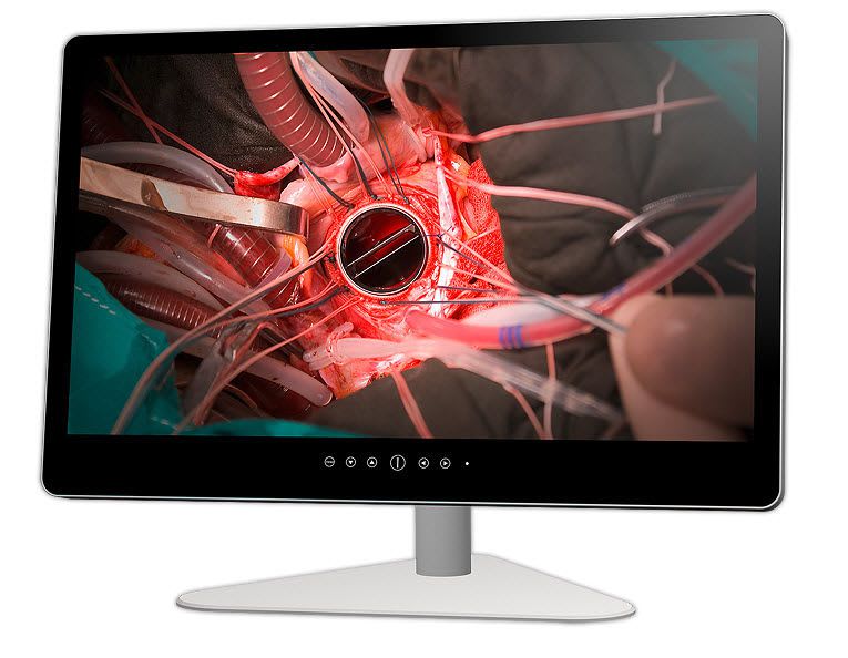 LCD display / medical 32" | ACL MD ACL Allround Computerdienst Leipzig GmbH