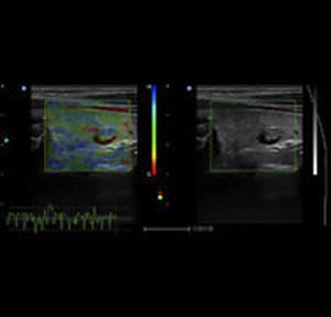 Ultrasound system / on platform / for multipurpose ultrasound imaging Apogee 5800 SIUI