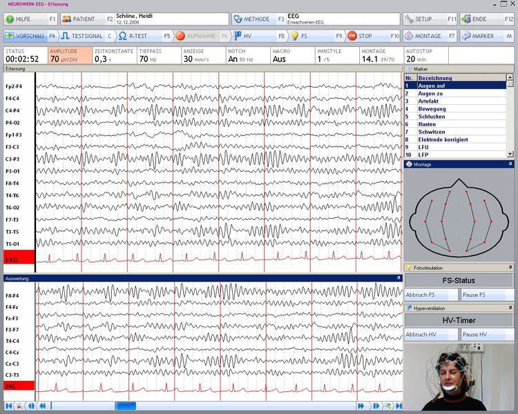 EEG software / medical SIGMA Medizin-Technik