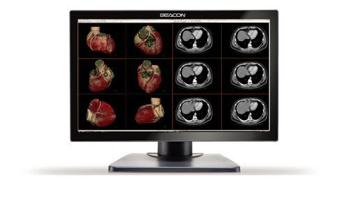 High-definition display / LCD / medical 30'', 4MP | C42W+ Shenzhen Beacon Display Technology Co., Ltd.