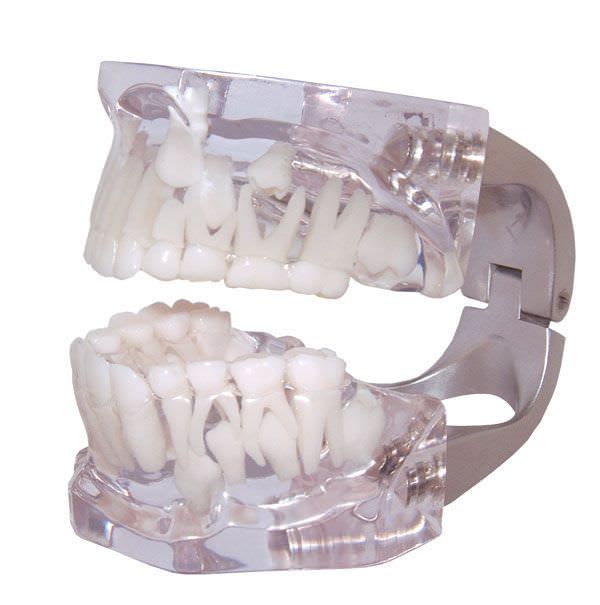 Denture anatomical model / child 41/0904 PRODONT-HOLLIGER