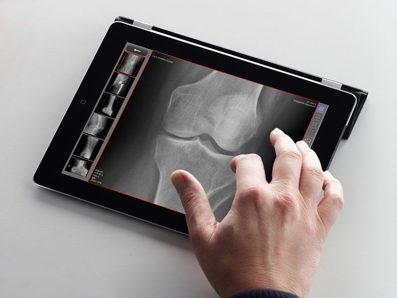 Sharing web application / viewing / medical imaging dicomPACS® MobileView OR Technology - Oehm und Rehbein