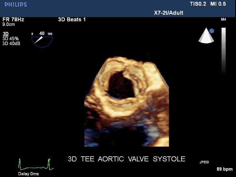 Ultrasound system / on platform / for cardiovascular ultrasound imaging iE33 xMATRIX Philips Healthcare