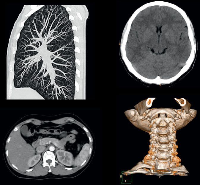 X-ray scanner (tomography) / full body tomography / 16-slice / standard diameter MX16EVO Philips Healthcare