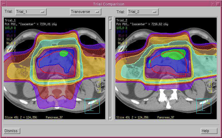 Planning software / medical / oncology / for radiation therapy Pinnacle³ 9.8 Philips Healthcare
