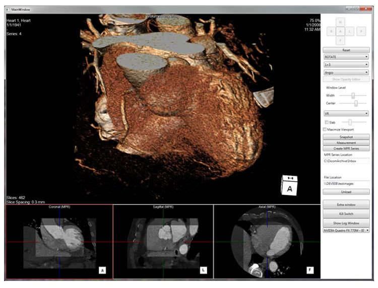 Diagnostic software / 3D viewing / medical / cardiology 3mensio 3D Pie Medical Imaging