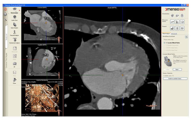 Reporting software / analysis / medical / for cardiology 3mensio Mitral Pie Medical Imaging