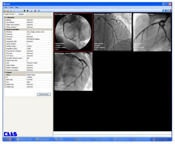 Reporting software / analysis / medical / for cardiology CAAS QCA Pie Medical Imaging