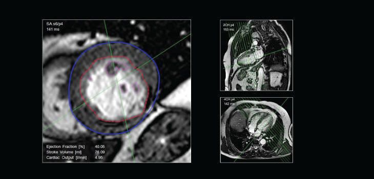 Reporting software / analysis / MRI / medical CAAS MRV Pie Medical Imaging