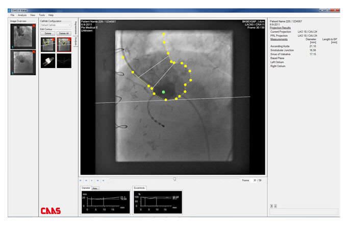 Analysis software / reporting / for cardiology / medical CAAS A-VALVE Pie Medical Imaging