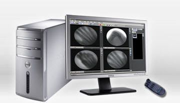 Nuclear medicine computer workstation / medical ORPAXERA Paxeramed Corp