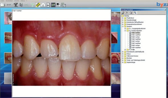 Viewing software / medical / for dental imaging byzz orangedental