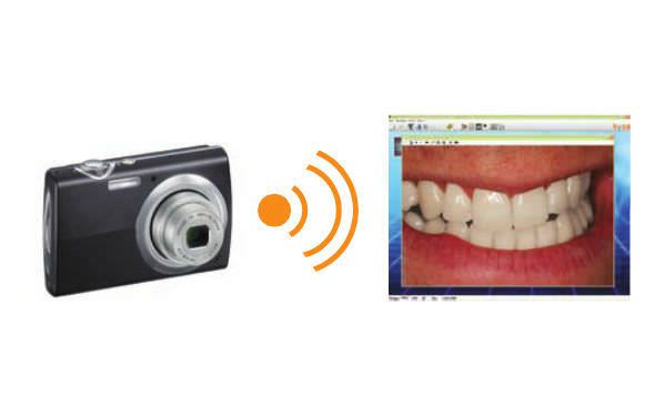 Dental imaging iOS application ibyzz orangedental