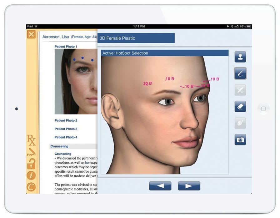 Facial modeling software / for reconstructive surgery / for plastic surgery Nextech
