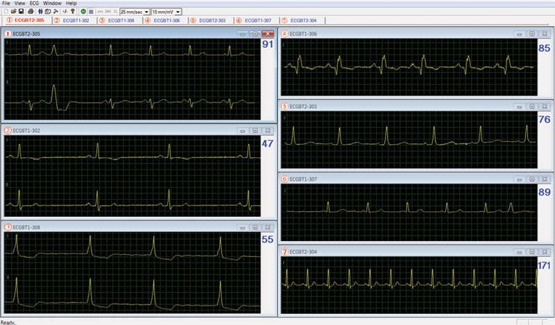 Digital electrocardiograph / computer-based / 6-channel ECG NM700 NORAV Medical