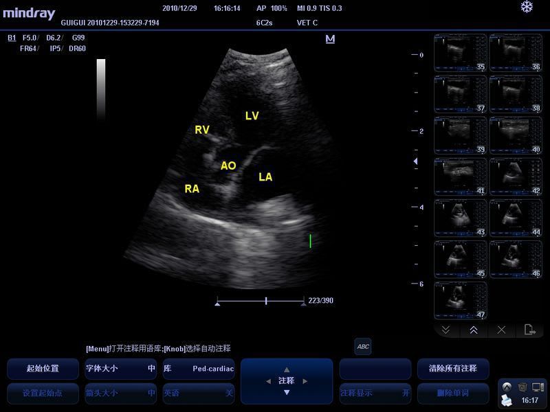 Portable veterinary ultrasound system M5 Vet Mindray