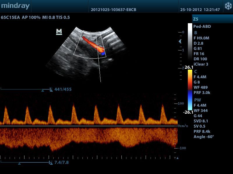 Portable veterinary ultrasound system Z5 Vet Mindray