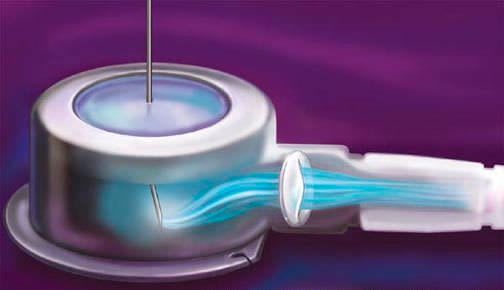 Single-lumen implantable port Vaxcel® Navilyst medical