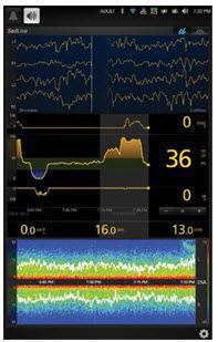EEG patient monitor / anesthesia SedLine® Masimo