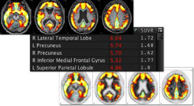 Diagnostic software / 3D viewing / for neuroimaging / medical mim neuro MIM Software