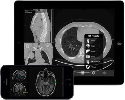 Medical imaging iOS application mobile mim MIM Software