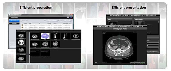 Viewing software / diagnostic / medical / nuclear medicine Casemeeting Mirada Medical